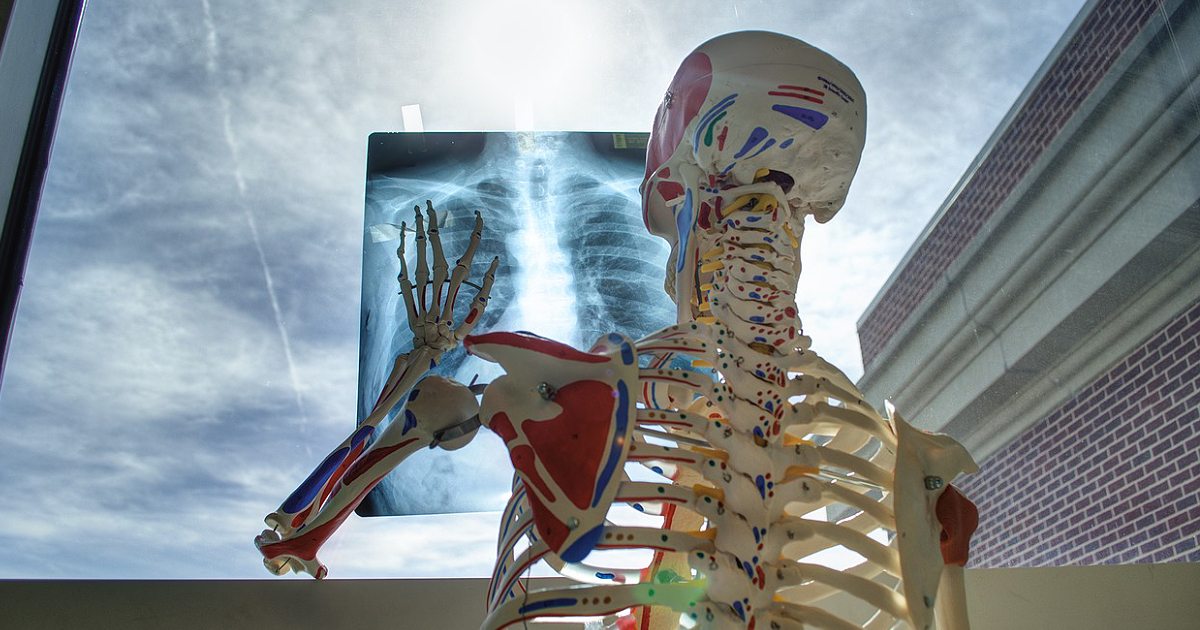 Image by StockSnap from Pixabay